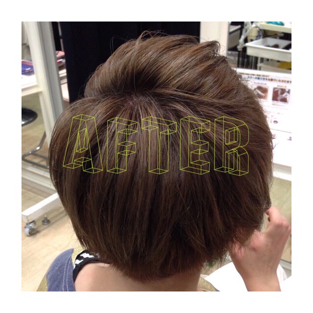 アフター