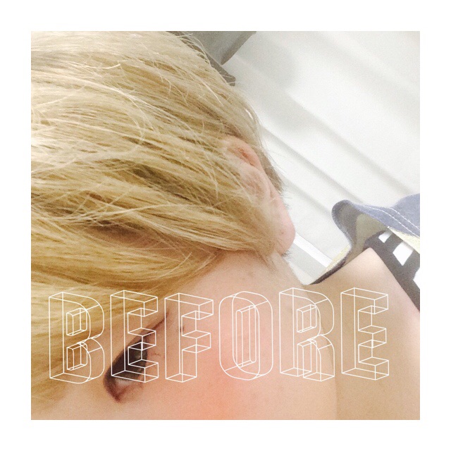 ビフォー